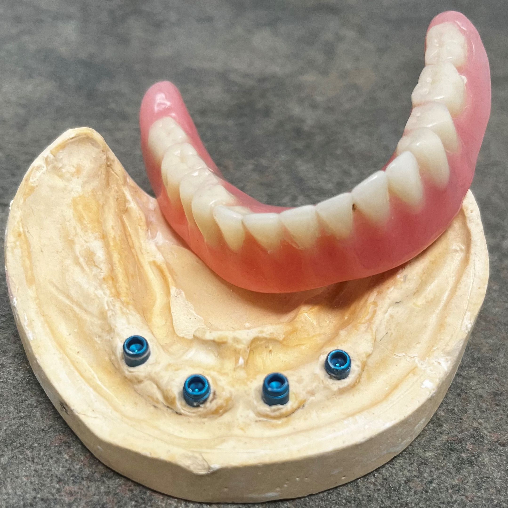 Peace Arch Denture Clinic logo