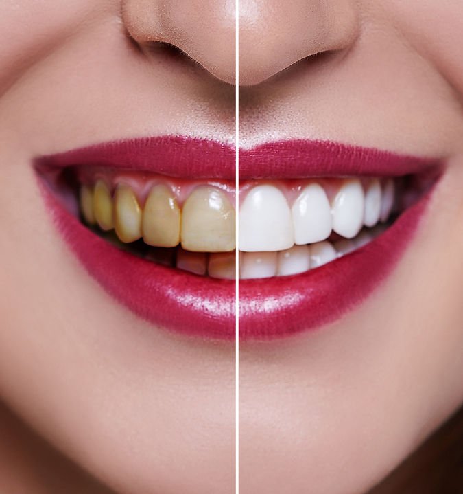 Hi5 Smiles Dental