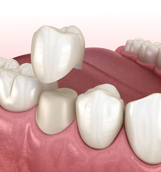 Hi5 Smiles Dental