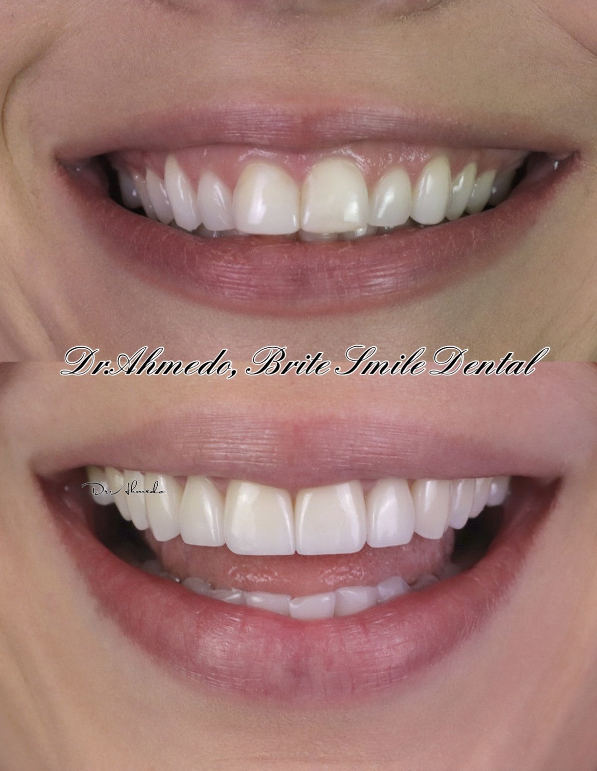 Brite Smile Dental – Dentist in San Diego