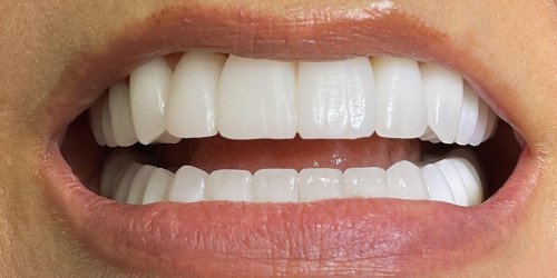 Chester Springs Dental
