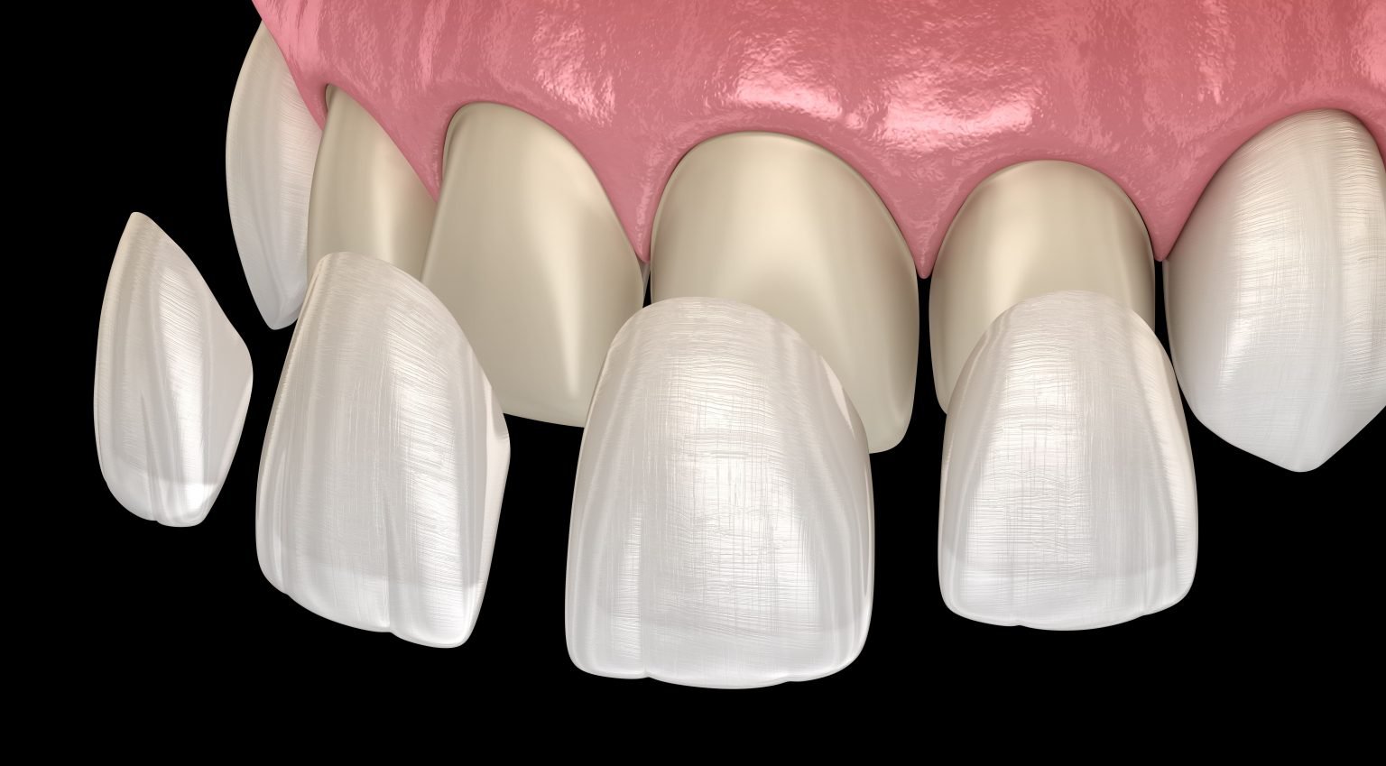 Chester Springs Dental