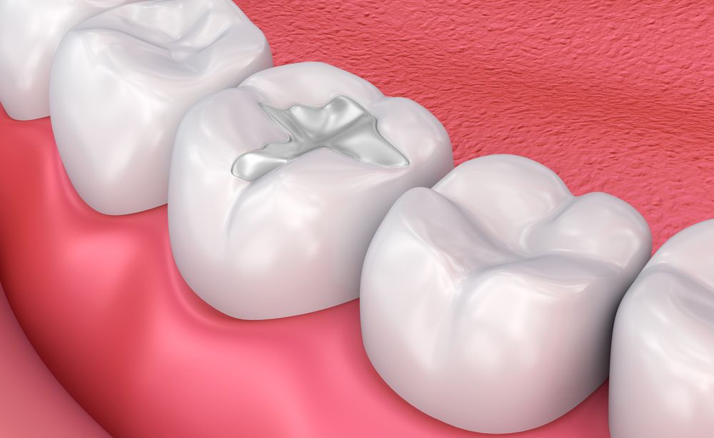 Chester Springs Dental