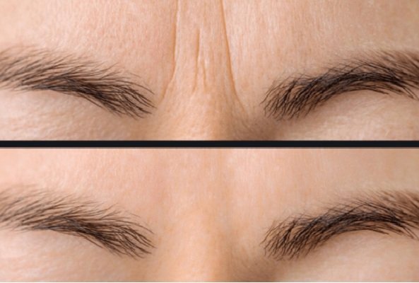 Distill Laser Clinic