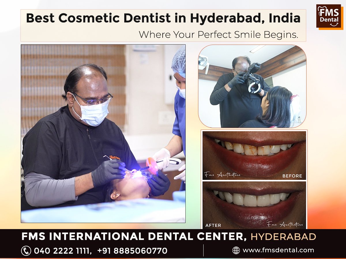 Best Cosmetic Dentist in Hyderabad, India – Dr. PP Reddy and His Expert Team at FMS International Dental Center
