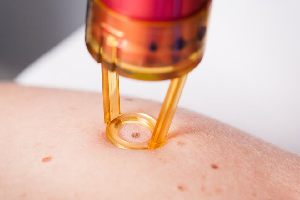 Distill Laser Clinic