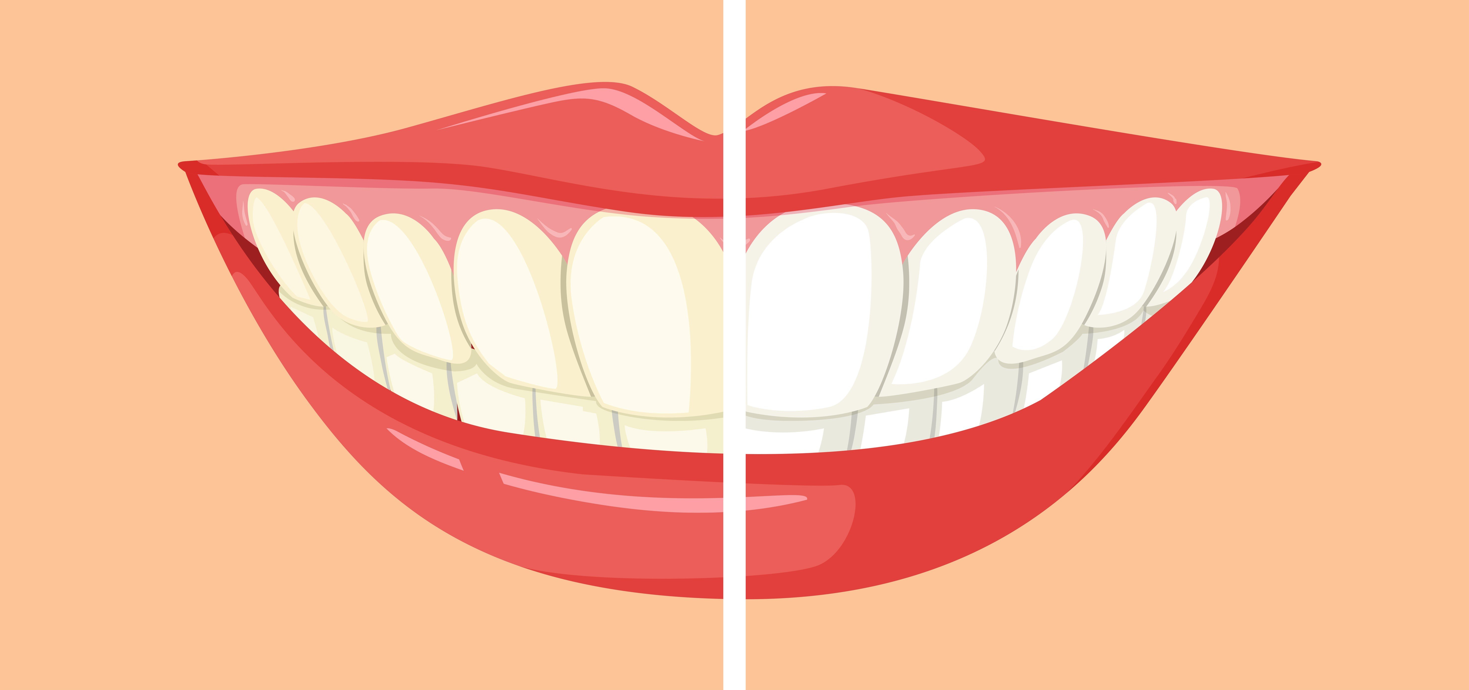Dental and Braces