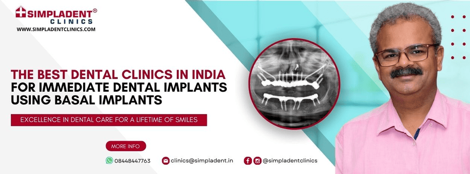 Full Dental Implant Cost India