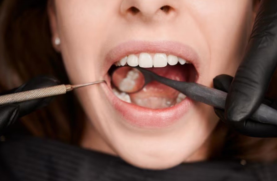 Western Piedmont Dental