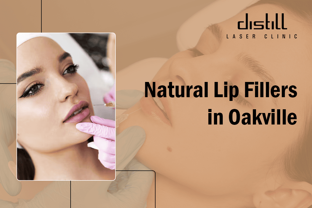 Best Lip Injections &amp; Fillers in Toronto