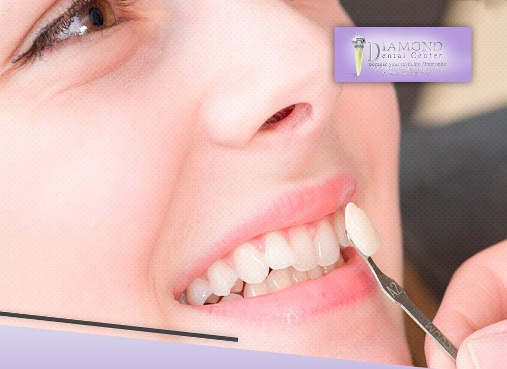 Diamond Dental Center