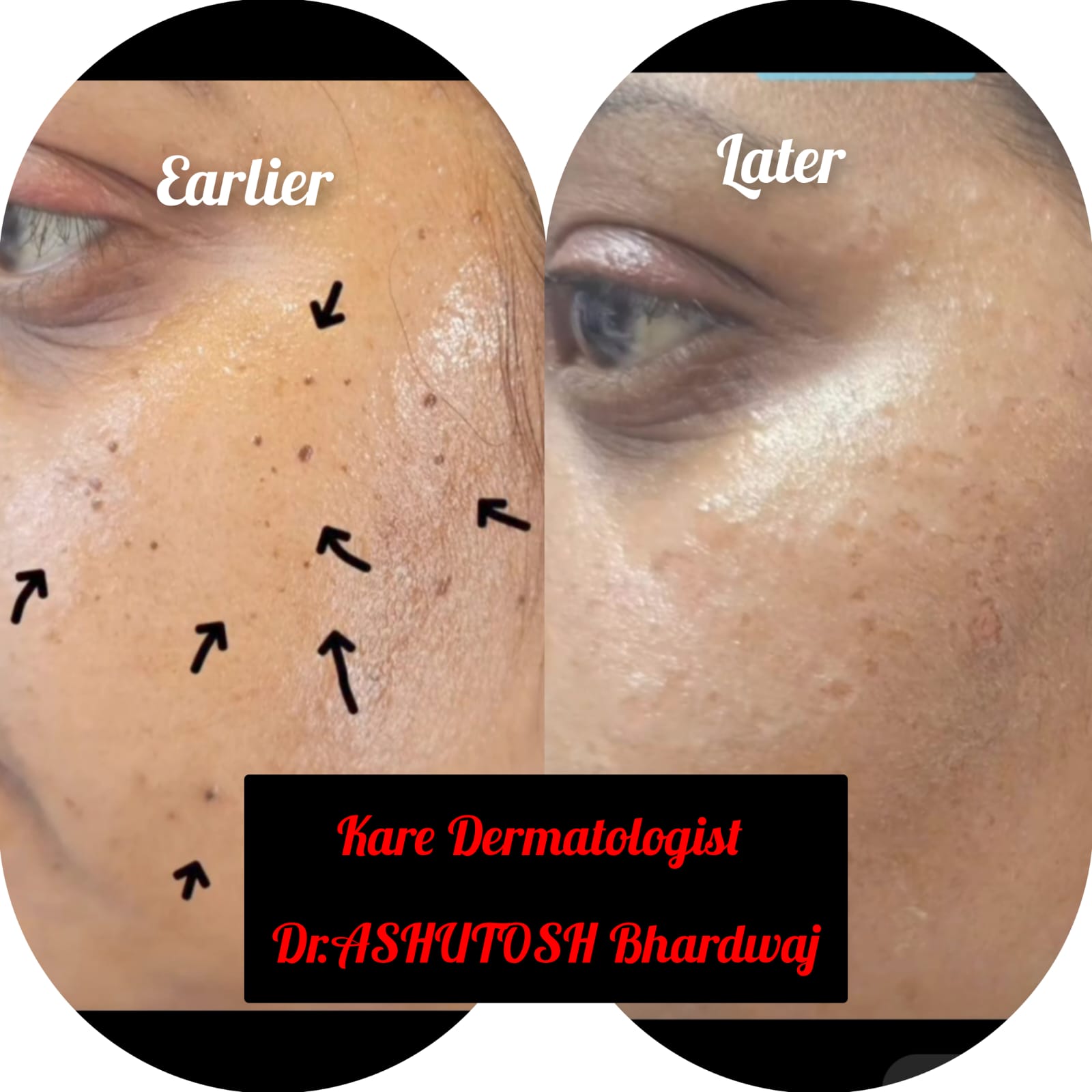 Kare Dermatologist Clinic