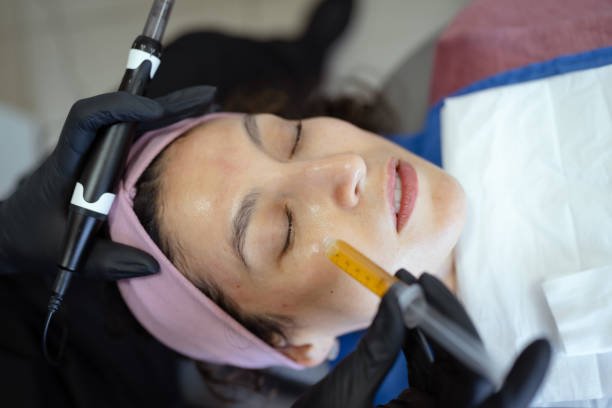 PRP For Face in Riyadh