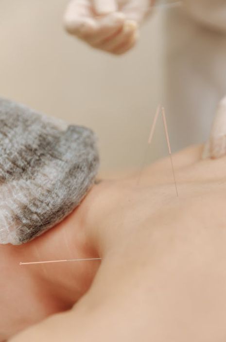 Juheng Acupuncture Clinic