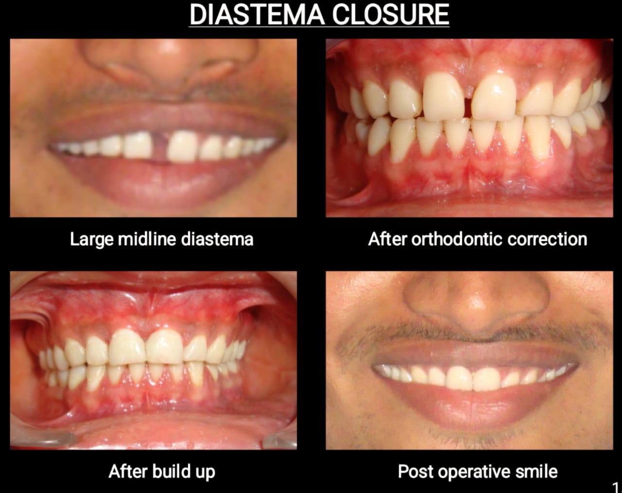 DENT-O-TOUCH – Advanced Laser Dental Clinic