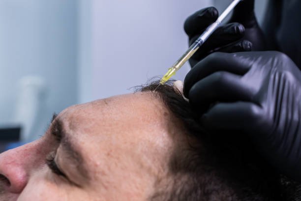 PRP Hair Treatment in Riyadh