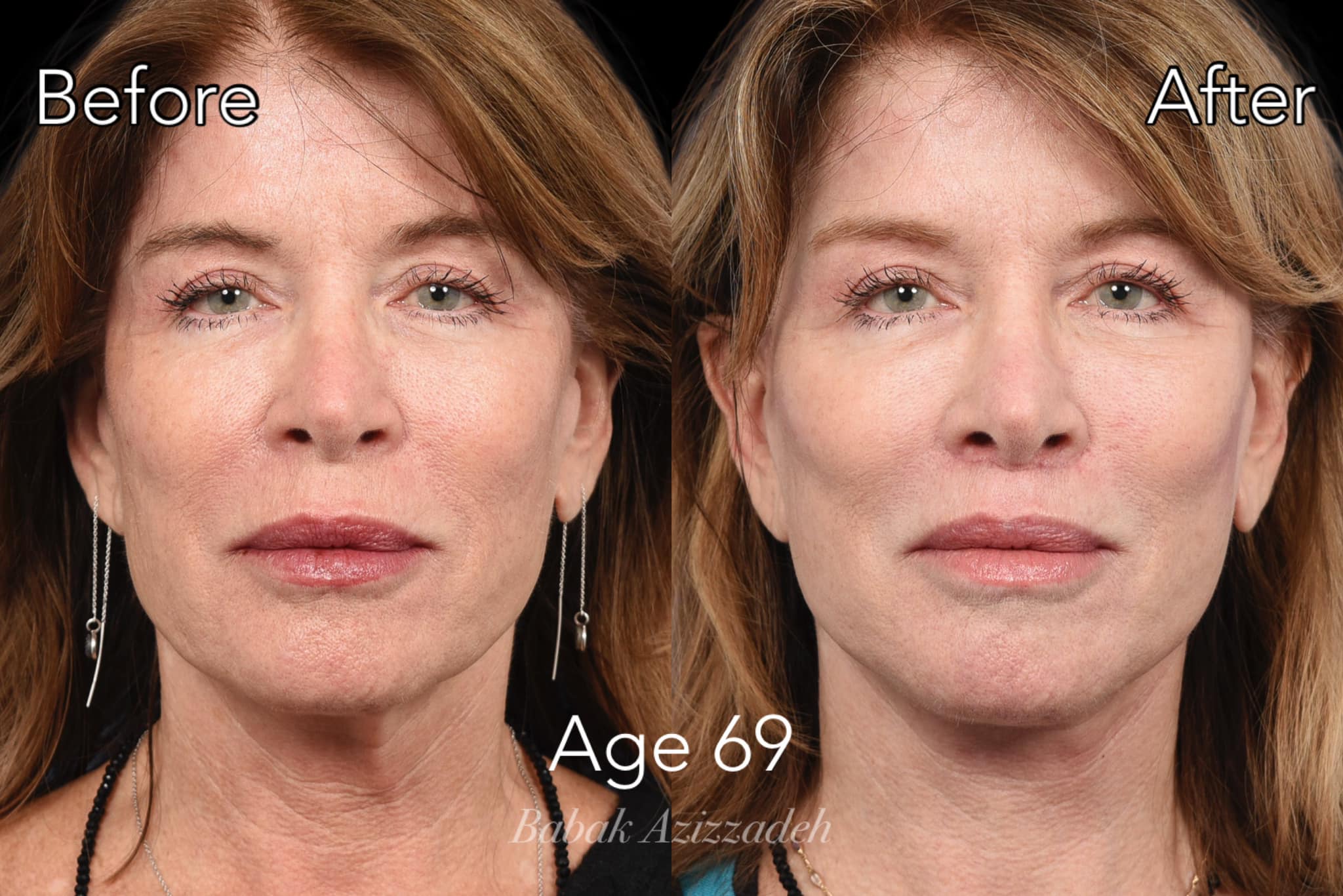 Center For Advanced Facial Plastic Surgery
